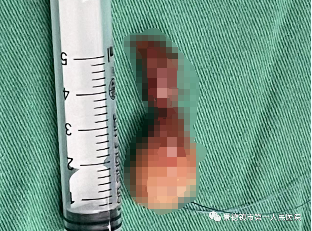 1662617444166751.png image.png